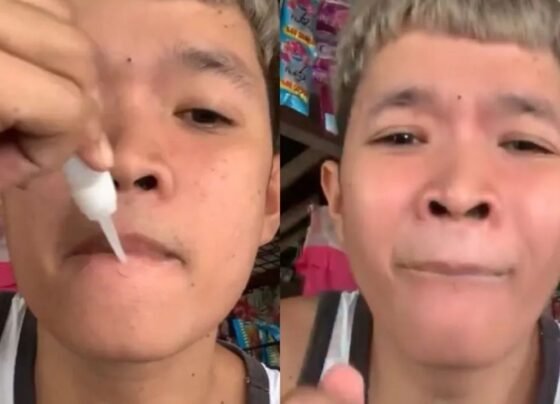 Boy lip Stuck Due To Fewi quick Shocking Video Goes Viral on Social Media