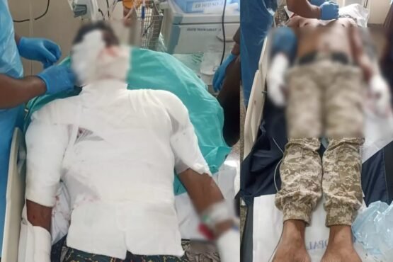 Major accident during mock drill in Bhopal