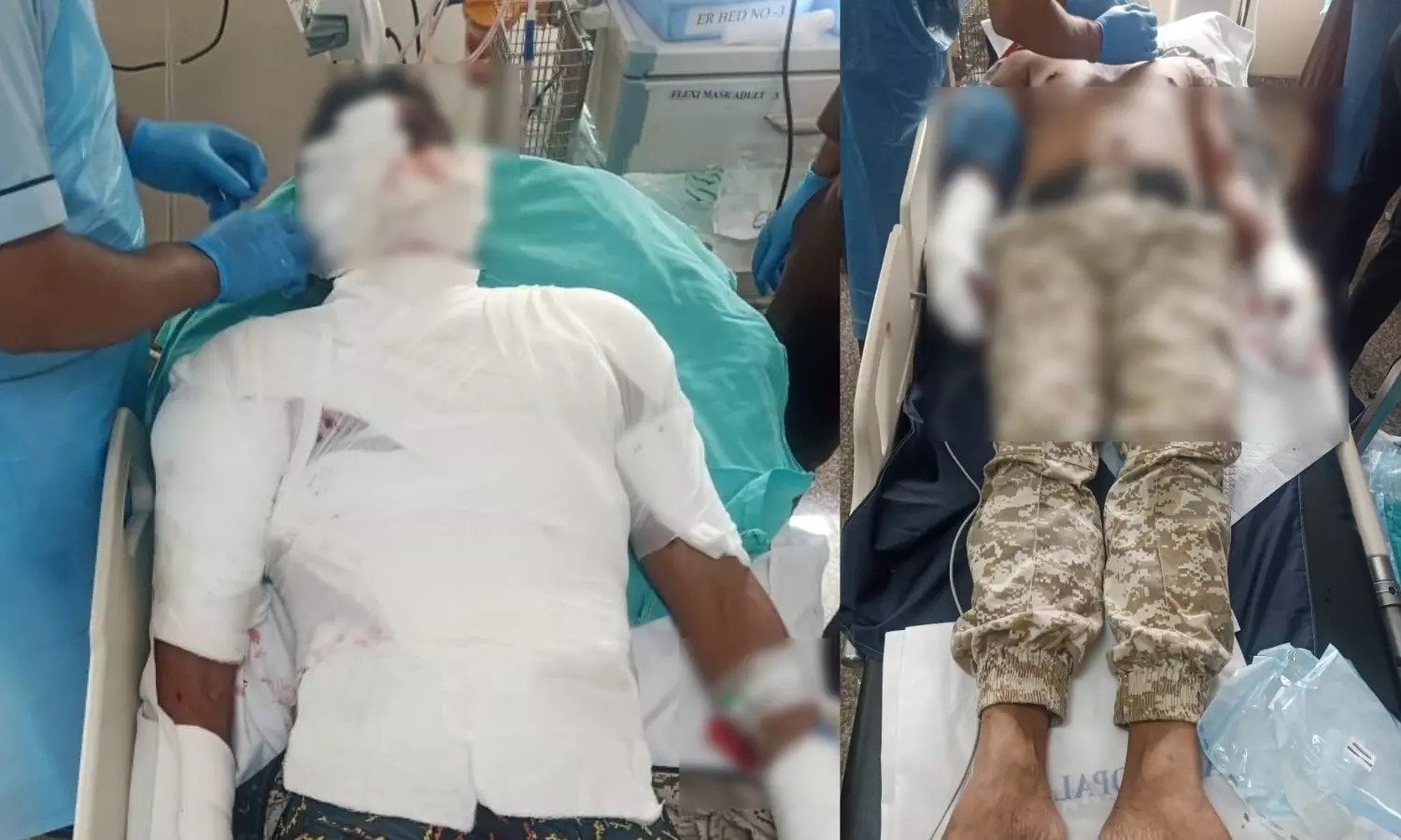 मॉक ड्रिल के दौरान बड़ा हादसा: हैंड ग्रेनेड फटने से दो पुलिसकर्मी घायल, एक की हालत गंभीर