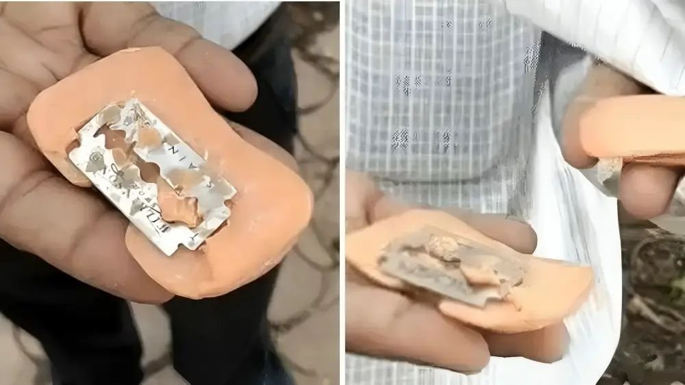 नहाने के साबुन में निकली ब्लेड, बच्चे का चेहरा हुआ लहूलुहान, परिवार शिकायत लेकर पहुंचा उपभोक्ता फोरम
