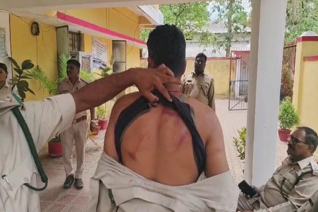 Balod News: वन विभाग की टीम पर लाठी डंडों से हमला, भागकर बचानी पड़ी जान, डिप्टी रेंजर समेत कई लोग हुए घायल