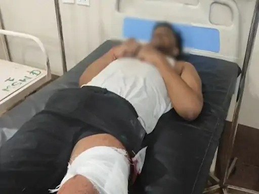 दुर्ग में पुरानी रंजिश को लेकर स्कूली छात्रों में चाकूबाजी, बीच-बचाव करने गए बड़े भाई को भी मारा, अस्पताल में भर्ती