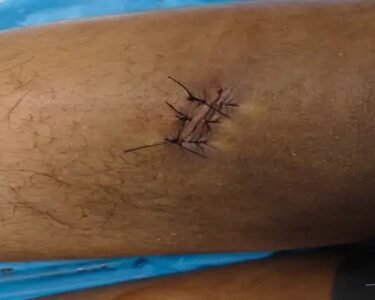 Raipur Chakubaji News