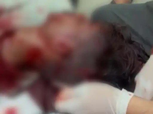 Raigarh Crime News : पुरानी-रंजिश में धारदार हथियार से युवक पर हमला, हाथ और सिर पर आई गंभीर चोट