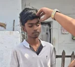 Bhilai Jaundice Outbreak News