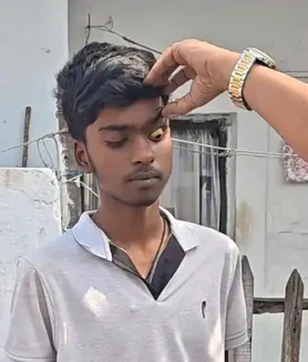 Bhilai Jaundice Outbreak News