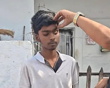 Bhilai Jaundice Outbreak News