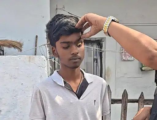 Bhilai Jaundice Outbreak News