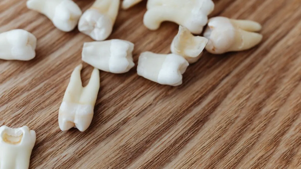 दिल्ली: व्यक्ति ने गलती से निगला नकली दांत, लेजर तकनीक से डॉक्टरों ने बचाई जान