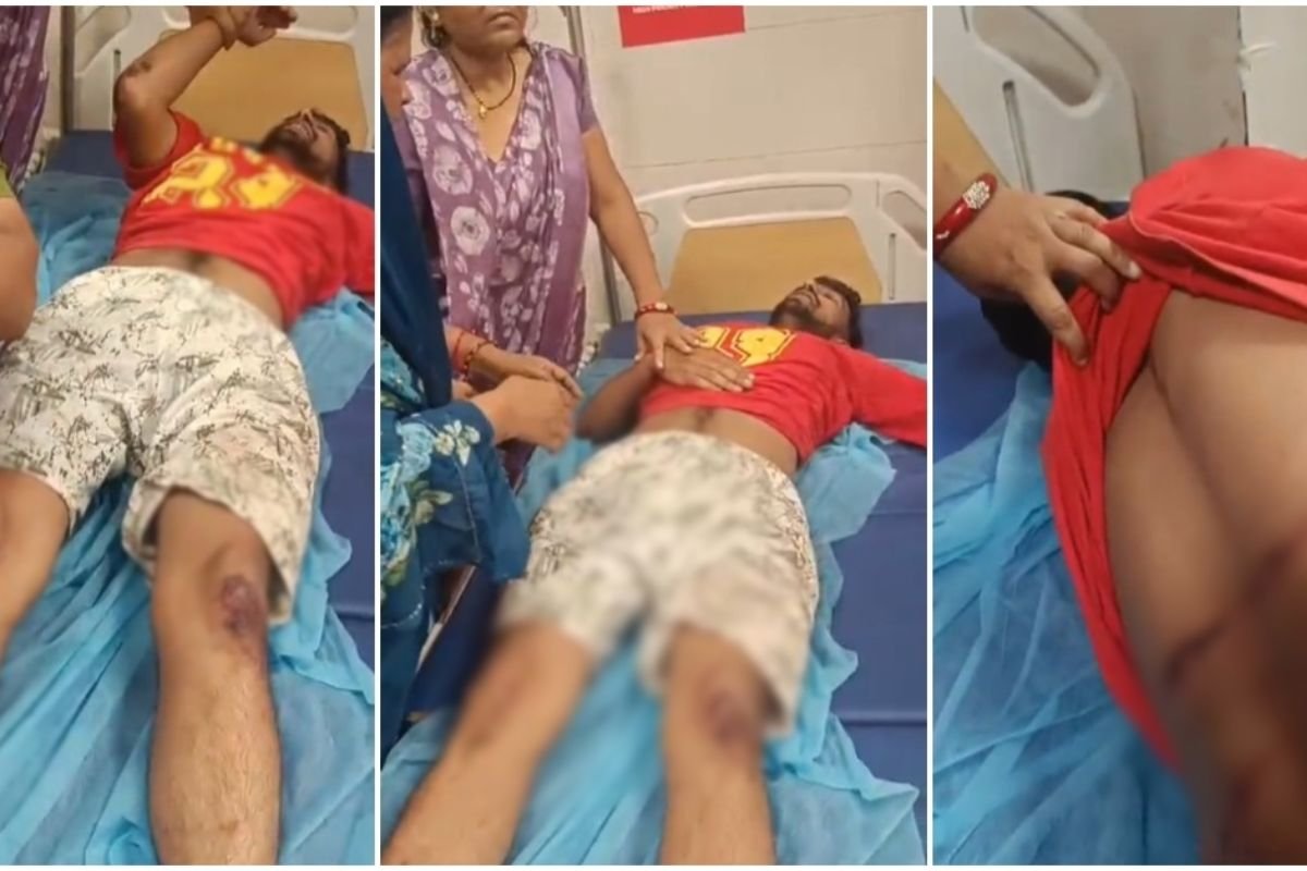 Bhopal News:भोपाल के MLA रेस्ट हाउस के बाहर बवाल, विधायक के बेटे पर हमला, सुरक्षा व्यवस्था पर उठे सवाल