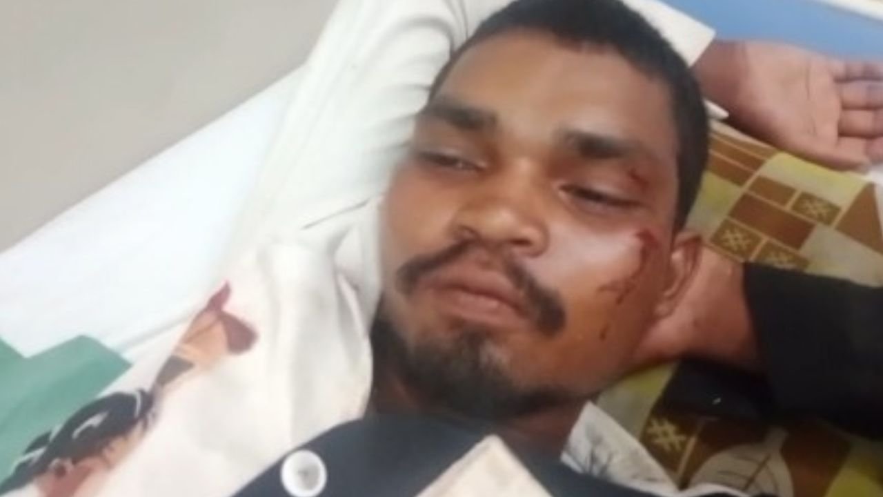 Bilaspur Crime News: बिलासपुर में हरेली से पहले बवाल, मुर्गे के आकार को लेकर भाई ने छोटे भाई को किया घायल