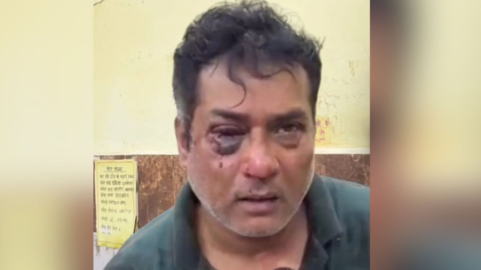 Ambikapur News: राजनीतिक रंजिश में कांग्रेस नेता पर जानलेवा हमला! भाजपा नेता ने आरोपों को बताया बेबुनियाद