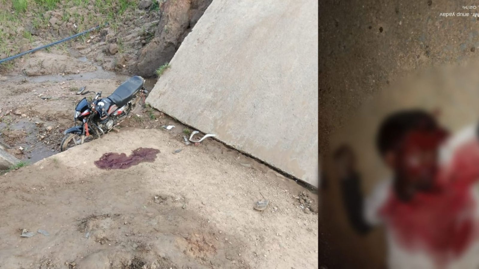 Balrampur News: सड़क मरम्मत की मांग के बीच हादसा, युवक की मौत के बाद 48 घंटे का अल्टीमेटम