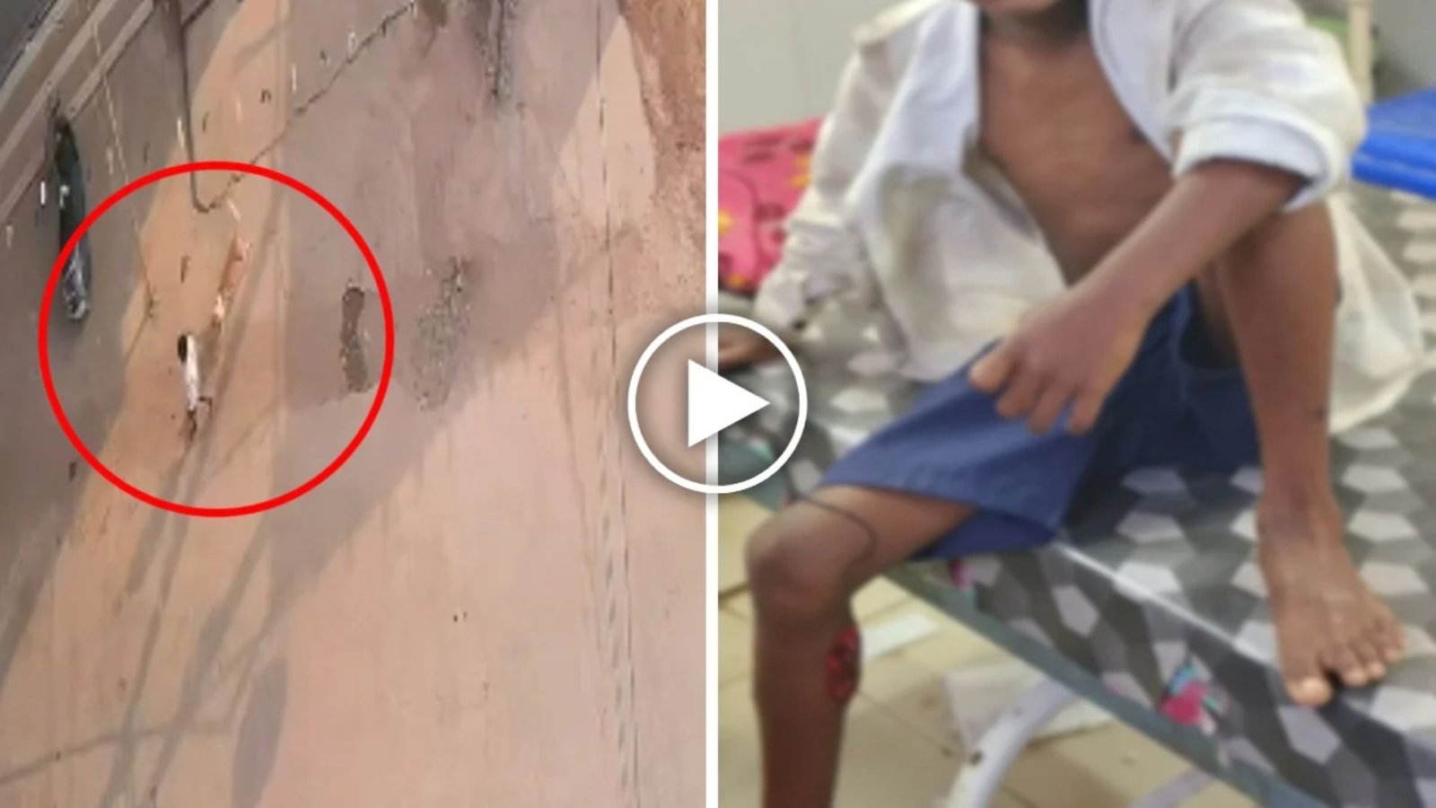 Sarangarh-Bilaigarh News : कुत्ते के हमले से मचा हड़कंप, जिला अस्पताल में 31 घायलों को लगाया गया एंटी-रेबीज इंजेक्शन