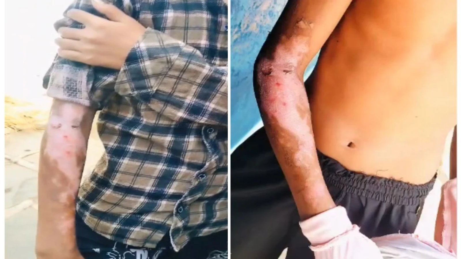 Gariyaband News: रसोई में हादसे के बाद छात्रों का जिला अस्पताल में कराया गया इलाज, परिजनों ने उठाए व्यवस्था पर सवाल