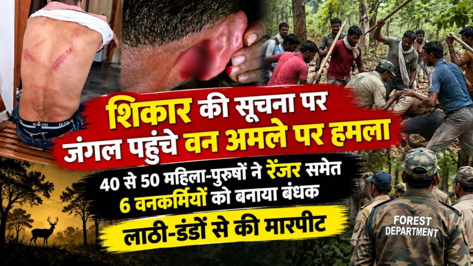 Mahasamund News : जंगली सूअर के शिकार की जांच करने पहुंची टीम से मारपीट, घायल वनकर्मियों का कराया गया स्वास्थ्य परीक्षण